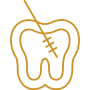 icono-endodoncia