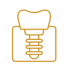 Implante Dental